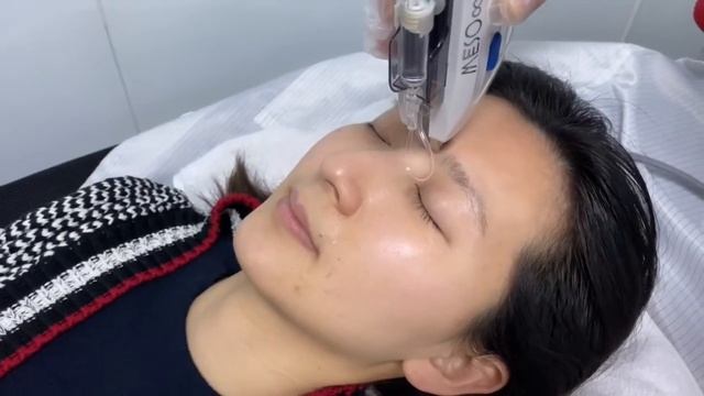 MESO Infinity mesotherapy device treatment