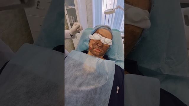 "Техника выполнения всесезонного лазерного карбонового пилинга"