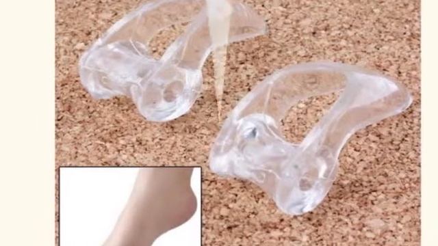 Вальгус Стопы У Детей смотреть онлайн