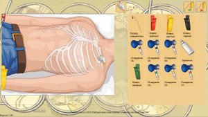 Electrocardiograph installation  (ЭКГ электрокардиограмма)