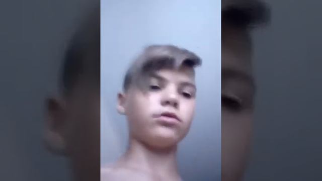 сломал пальцы!!! смотреть онлайн