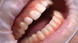 Знакомство с материалом OMNICHROMA. Уникальные отличительные особенности композита