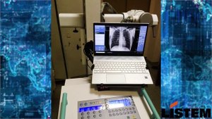 Обзор мобильного рентген аппарата LISTEM DMH-325