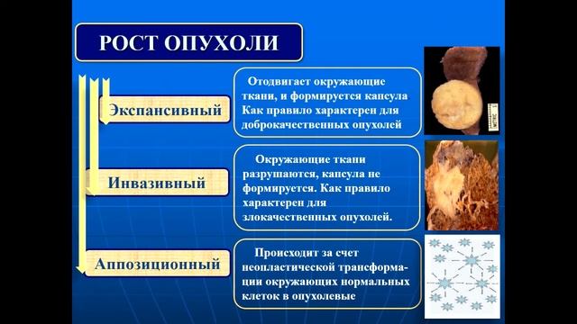 Патология - Лекция - Опухоли