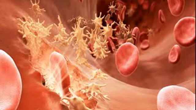 Диагноз в наследство. Гемофилия: чем она опасна? смотреть онлайн