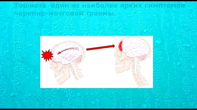 8 причин почему тошнит
