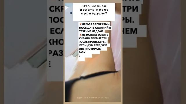 Что нельзя делать до и после лазерной эпиляцией диодным лазером. Сеть студий buddha24.ru