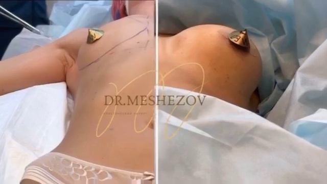 Как вам результат? 😊