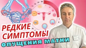 РЕДКИЕ СИМПТОМЫ Опущения Матки | Варикоз, Мочеиспускание и Выделения у женщин | Гинеколог Ермолаев