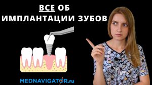 Имплантация зубов VS протезирование зубов. Как восстановить утраченные зубы? | Mednavigator.ru