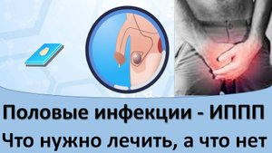 Половые инфекции - ИППП. Что нужно лечить, а что нет.