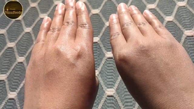 Honest review of Bio-Oil dry skin gel смотреть онлайн