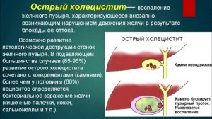 Камни в желчном пузыре. Причины желчекаменной болезни. Как избавиться от камней в желчном пузыре