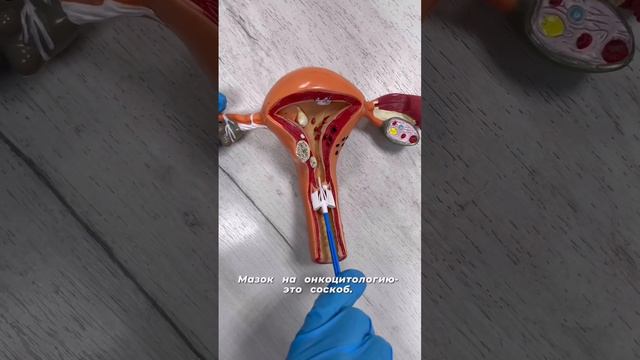 Как берут мазок на онкоцитологию смотреть онлайн
