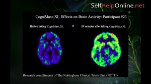 Cognimaxx XL Review - Help To Improve Cognitive Function And Ability