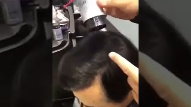 Как избавиться от лысины смотреть онлайн