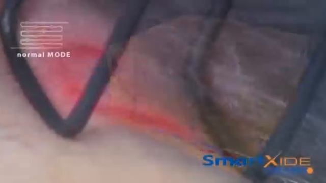 Фракционная шлифовка.avi смотреть онлайн