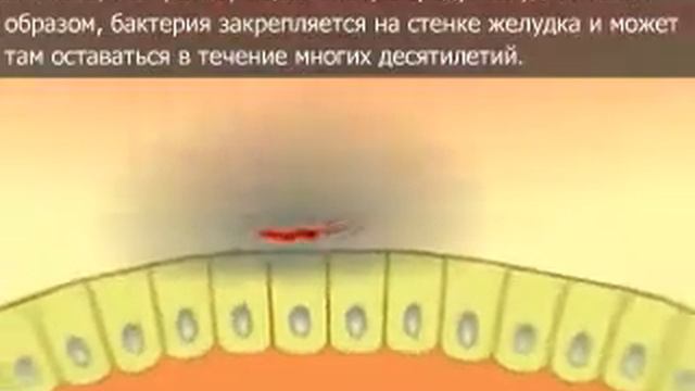 Хеликобактер пилори