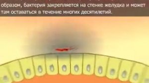 Хеликобактер пилори