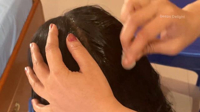 Home remedy for dandruff|ತಲೆ ಹೊಟ್ಟು ಮನೆಮದ್ದು|natural remedy for dandruff|Dandruff removal in kannad