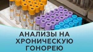 Как берут анализы на гонорею. Анализы на хроническую гонорею.