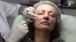 Почему с канюлей больше ощущается распирание