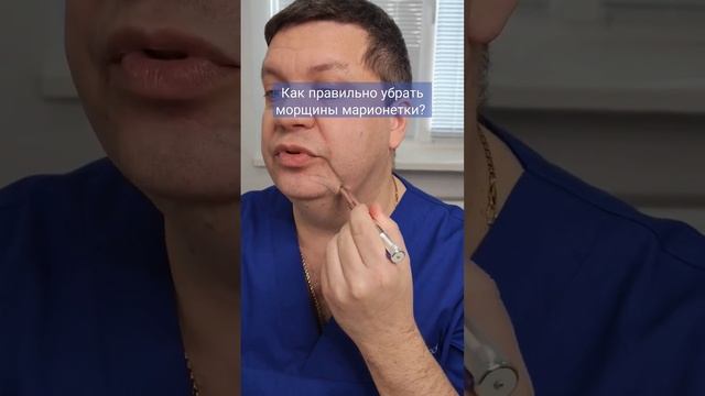 Как правильно корректировать морщины марионетки?