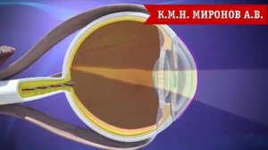 Астигматизм глаза. Причины, виды астигматизма.