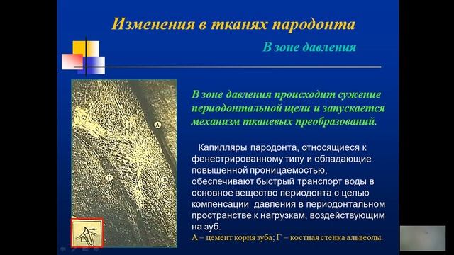 перемещения зубов смотреть онлайн