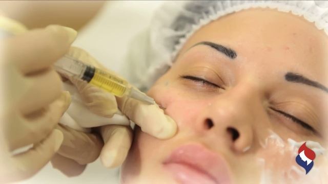 Плазмалифтинг смотреть онлайн