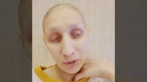 Рак шейки матки.3я стадия.Рецидив.Химия. ПЭТ- КТ.