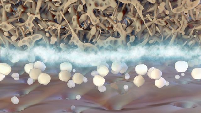 What is ACL Surgery? смотреть онлайн