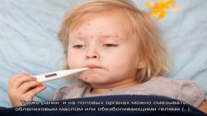 Как и чем лечить ветрянку в домашних условиях?