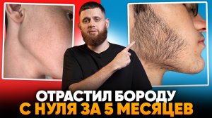 Результаты средства Mr.Volos за 5 месяцев / Отрастил бороду в 15 лет