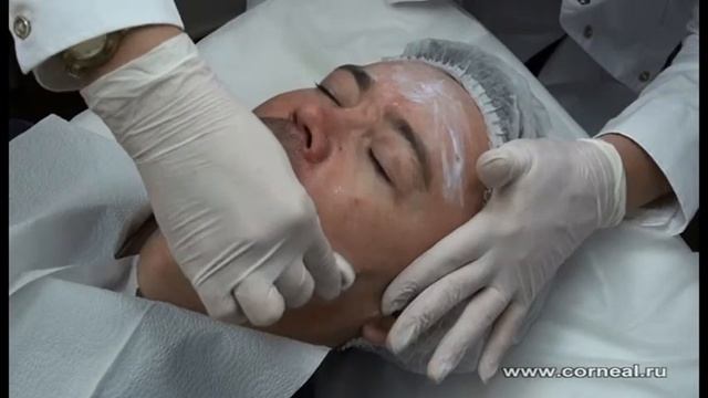 Химический пилинг SRT в действии смотреть онлайн