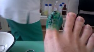 Снятие швов