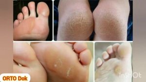 Подпяточники | для чего необходимы подпяточники | Амортизатор для стоп