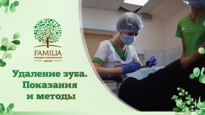 Удаление зуба. Показания и методы