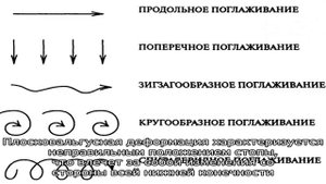 Массаж при вальгусе стоп у ребенка