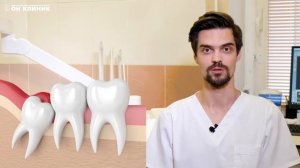 Удаление зубов мудрости ("восьмёрок") в ОН КЛИНИК. Ответы на вопросы.