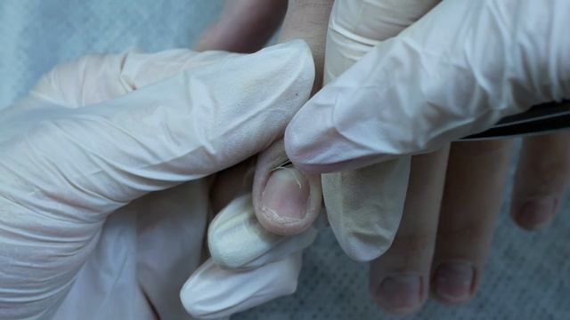 ЖУТКИЙ ГИПЕРГИДРОЗ: лайфхаки ? Маникюр на ВЛАЖНЫХ РУКАХ. Наращивание ногтей «ЛЁД». ЗИМНИЙ МАНИКЮР