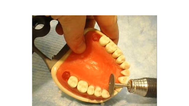 Equilibrate the dentoform смотреть онлайн