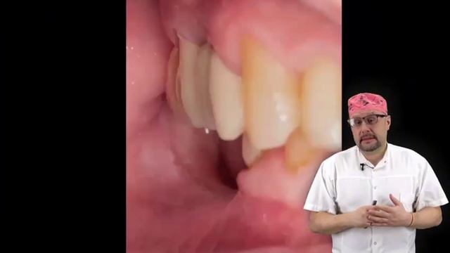 «Диаметр важнее длины» ? 😉