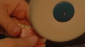 Изготовление зубных протезов Flexite часть 3