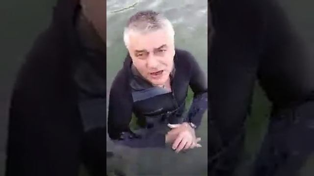 Рак кишечника(плоскоклеточный рак),1,2 ,3 стадии излечим