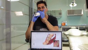 Обзор внутриротового сканера 3SHAPE TRIOS