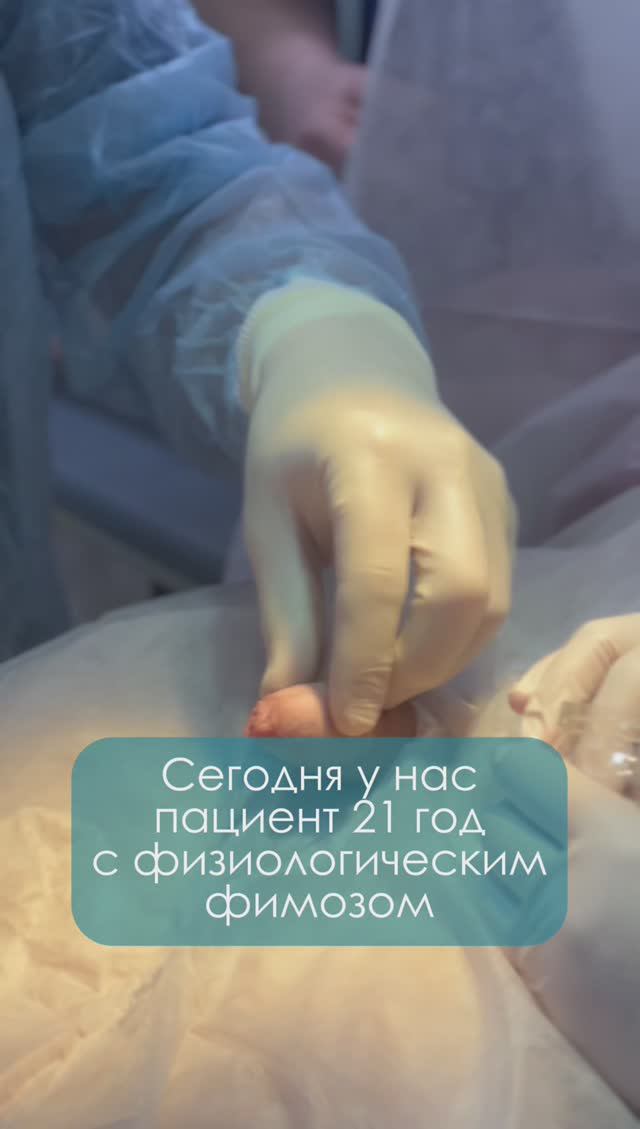 Физиологический фимоз. Видео БЕЗ ЦЕНЗУРЫ из операционной. СТРОГО 18+
#обрезание #урология