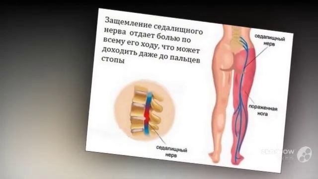 Боль в пояснице отдает в правую ногу ягодицу болит поясница отдает в ягодицу правую