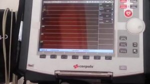 Corpuls® 3 Monitor-Defibrillator kullanımı 2