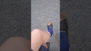 снятие пластин после перелома